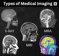 X-Ray, MRI, Medical imaging image